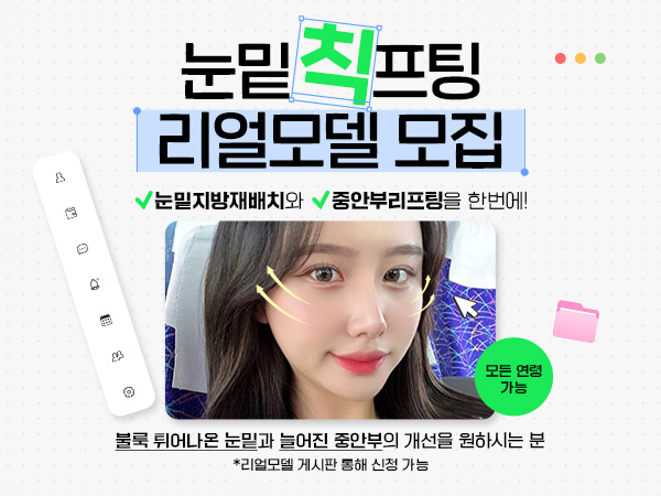 눈밑칙프팅 리얼모델 모집_홈피팝업.jpg